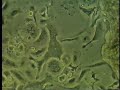 The Osteoclasts The Osteoclasts