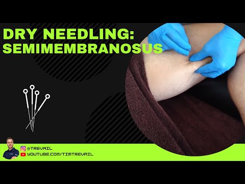 how to isolate semimembranosus