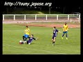 Montigny en D1 Montigny en D1