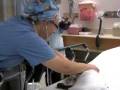 Craniofacial Procedure to Treat Encephalocele