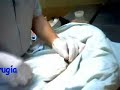 Técnica simplificada para la castración de gato macho