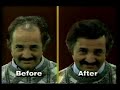 5mtl.com presents Couvre hair loss commercial