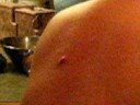 My First Zit