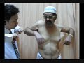 Rotator cuff tear preop shoulder examination Rotator cuff tear preop shoulder examination