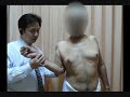 Shoulder Investigation Before Surgical Intervention In Rotator Cuff Tear Shoulder Investigation Before Surgical Intervention In Rotator Cuff Tear