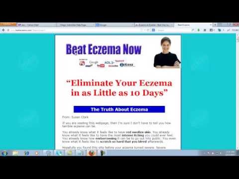 how to get rid of an eczema patch