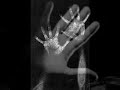 Bambino-El almendro triste