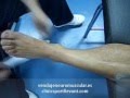 Paco Selva - Vendaje N. - Anterorización del maleolo externo del tobillo.