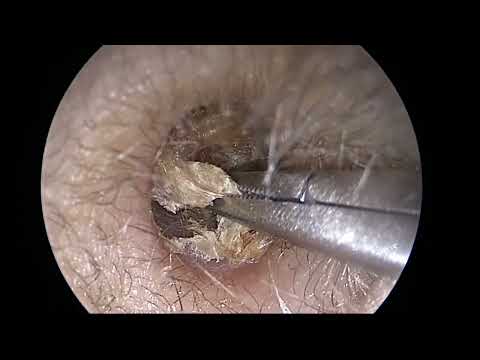 video-img