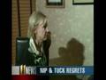 Hans Poppe Interviewed about Plastic Surgery Mistakes