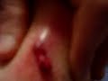 skin disease skin disease