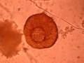 Tecameba Centropyxis aculeata