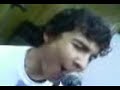 pulgar derecho chavo-6 voltios
