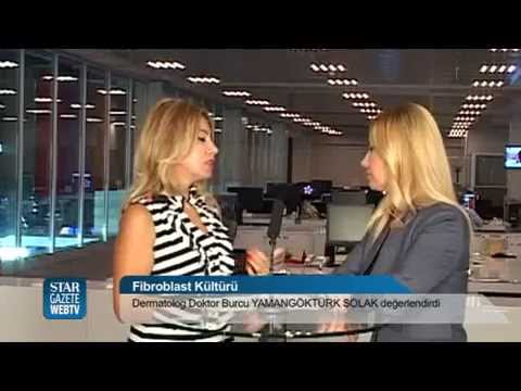 Fibroblast Kültürü Fibroblast Kültürü