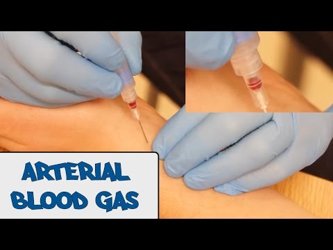 how to collect venous blood gas