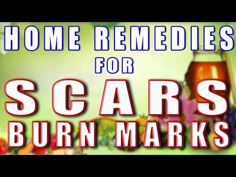 how to treat scars from a burn
