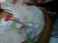 #Bahrain: Ahmed (4y/o) in the hospital after riot police shot birdshot gun at him. June13,2012