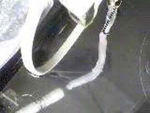 Ureter