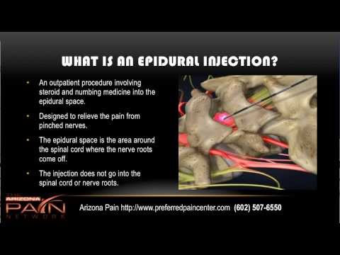 how to relieve epidural pain