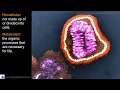 Influenza | Learn English | Vocabulary Builder