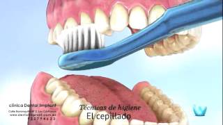 TÉCNICA DE CEPILLADO