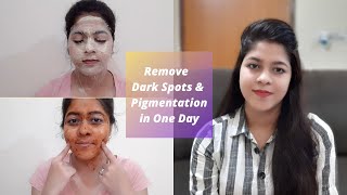 How to remove Dark spots and Pigmentation from Face Permanently