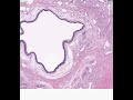 Shotgun-Histology-Ma