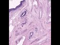 Shotgun-Histology-Ma