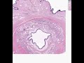 Shotgun-Histology-Ma