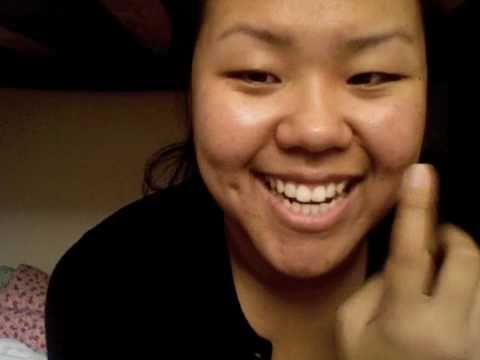 how to treat bell's palsy