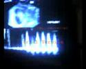 10 Semanas do meu Filho na barriga da mãe