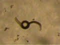 Antarctic Nematod