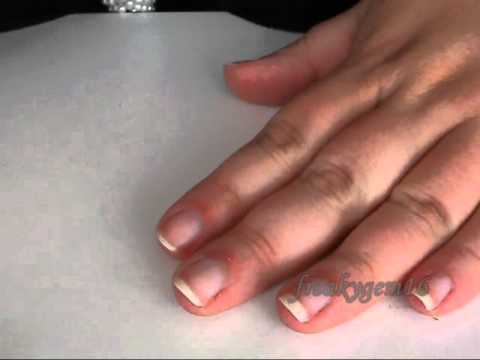 how to cure hangnail