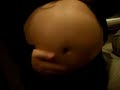 Tummy Tuck?