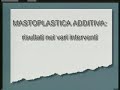 dr  antonio di vincenzo   mastoplastica additiva