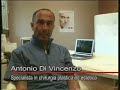 dr  antonio di vincenzo   mastoplastica additiva