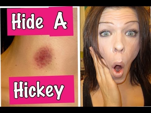 how to cover up a purple bruise