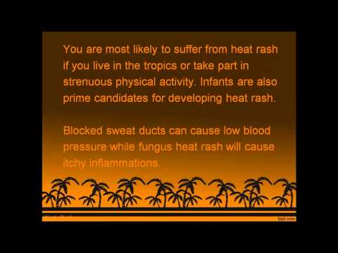 how to cure heat rash