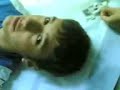 ameliyattan dehşet görüntüler