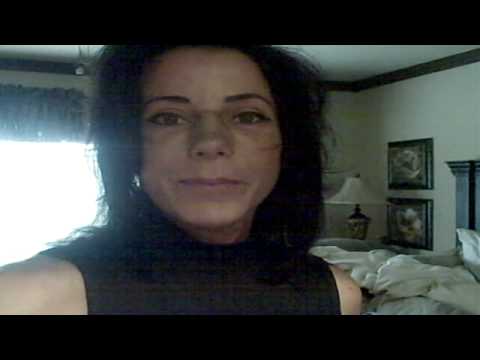 My Facial Plastic Surgery Blog - Recovery Day 15