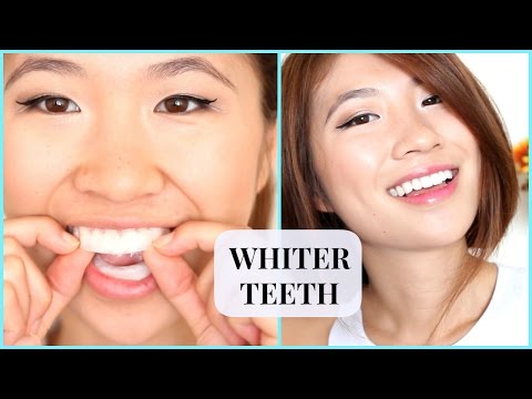 how to whiten asian teeth