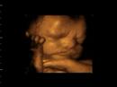 4D Ultrasound www.fetalvisionimaging.com 4D Ultrasound www.fetalvisionimaging.com