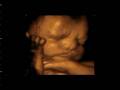 4D Ultrasound www.fetalvisionimaging.com
