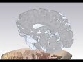 MRI Scan of Human Head