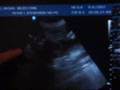 baby x ultrasound at 31 weeks