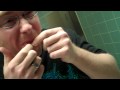 Miles' HUGE ZIT being POPPED