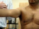 Pectoralis Major (sternal & clavicular) Pectoralis Major (sternal & clavicular)