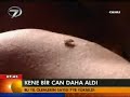Kene ısırması ile KATÜ'ye kaldırılan bir kadın hayatını kaybetti