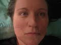How does Myalgic Encephalomyelitis affect my life?