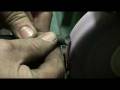 Guarda video
